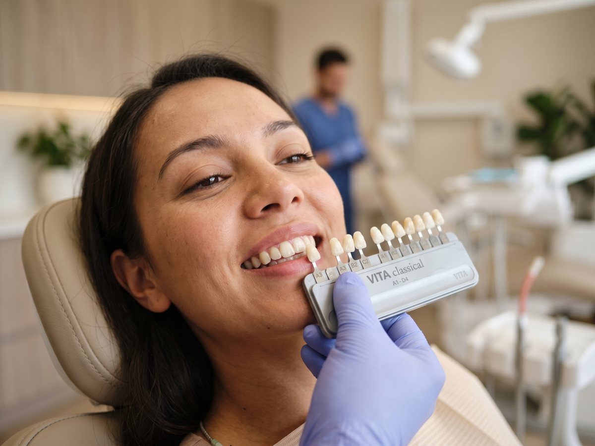 A dentist matching a tooth shade guide to a patient's smile during smile-makeover planning