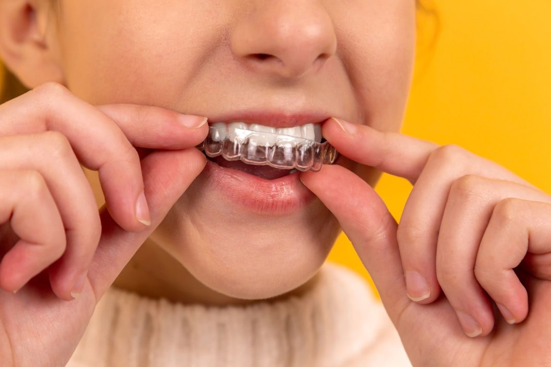 A clear orthodontic aligner held up before fitting